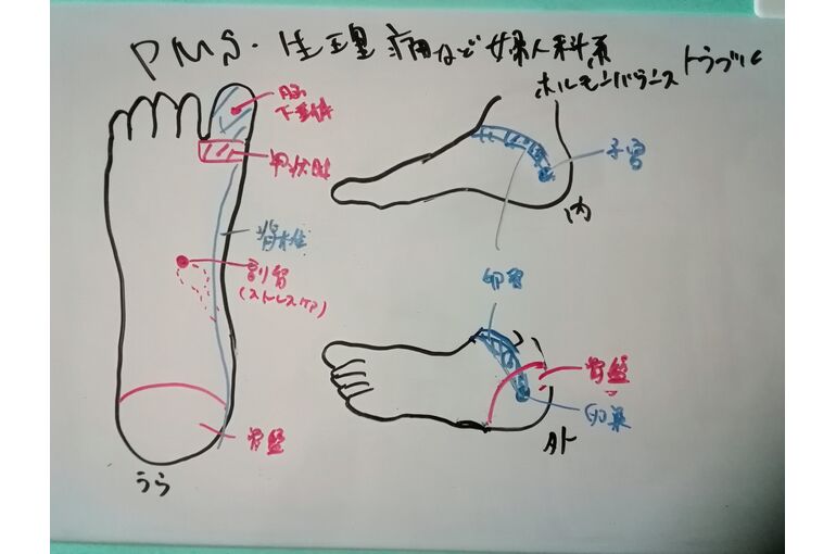 リフレ