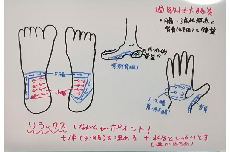 過敏性腸症候群リフレ