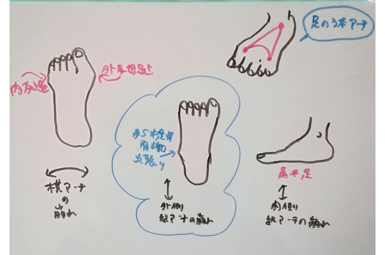 足のトラブルイラスト