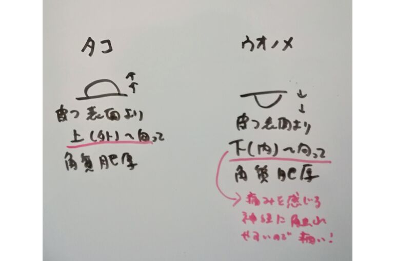 タコ・魚の目