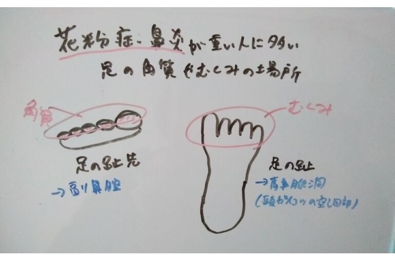 リフレイメージ